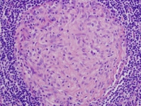 Ağız İçi Epitel Hücresi Özellikleri ve Faydaları Nelerdir? Ağız İçi Epitel Hücresi Özellikleri ve Faydaları Nelerdir?